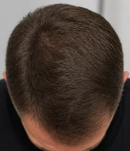 Mark R. after