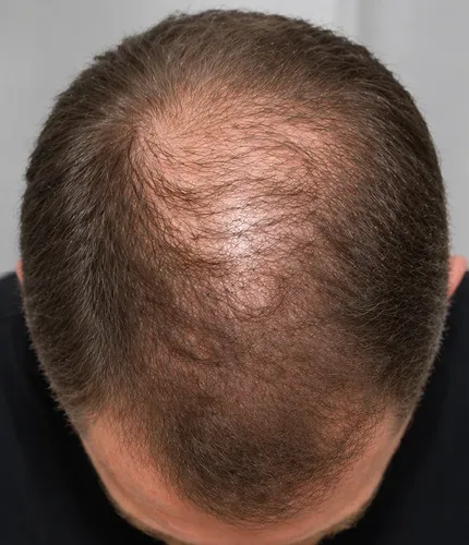 Mark R. before